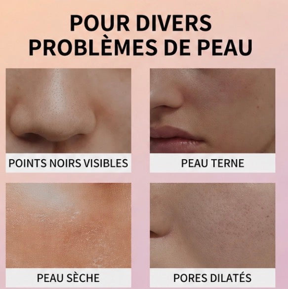 Ampoule Exfoliante au Riz Noir – Eau de Son de Riz + Niacinamide